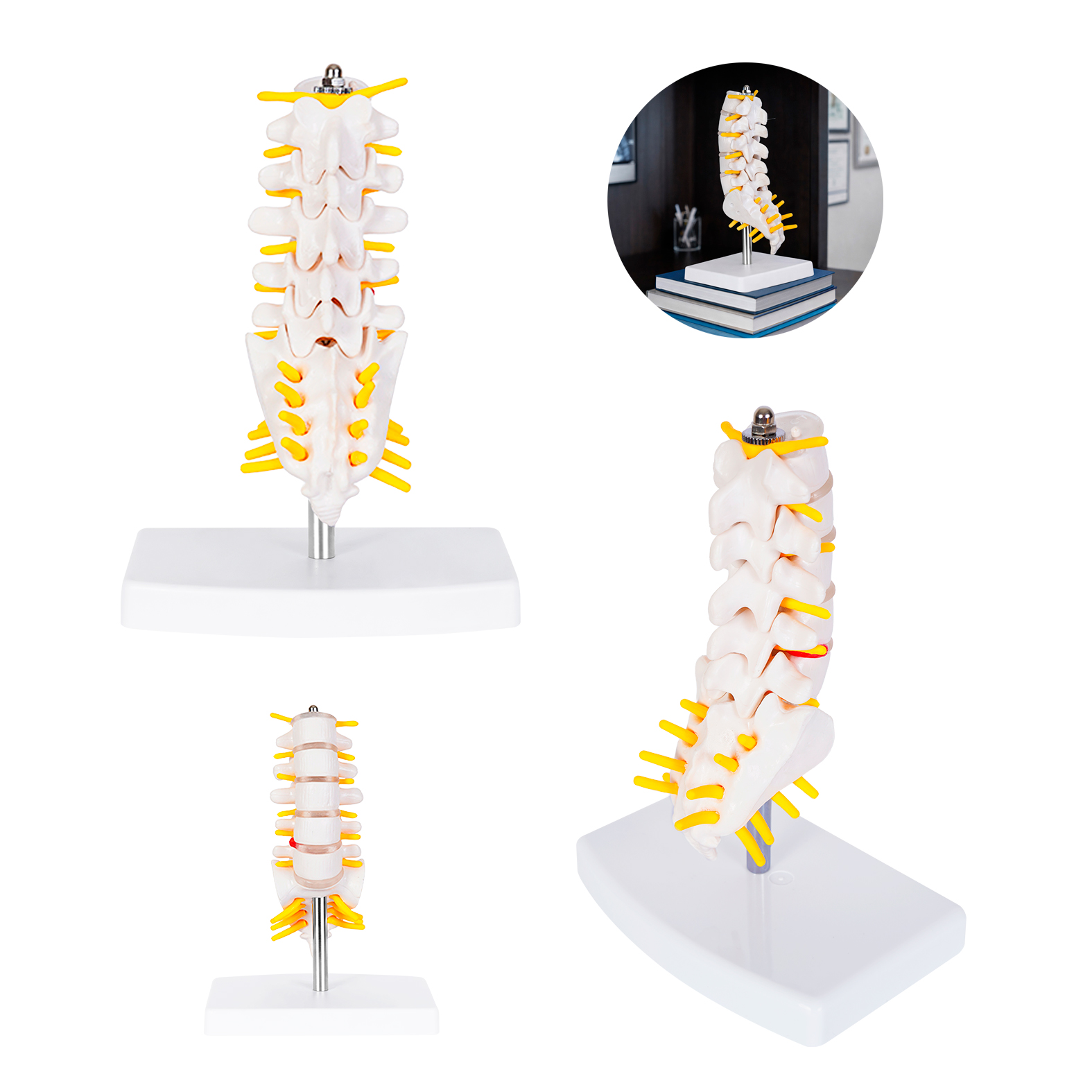F